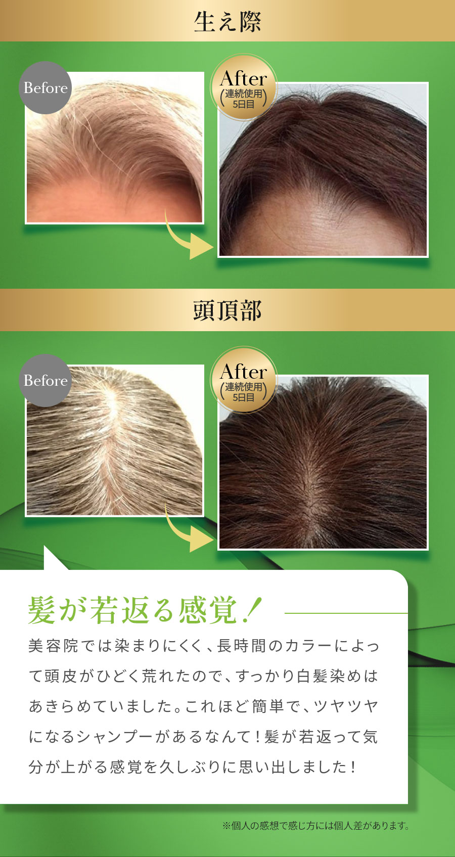 生え際、頭頂部